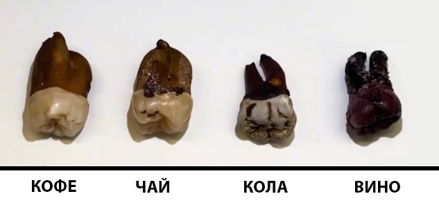 Какие напитки опасны для зубов? Результаты исследования стоматолога